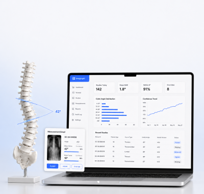 AI Cobb angle measurement dashboard for a medical imaging platform